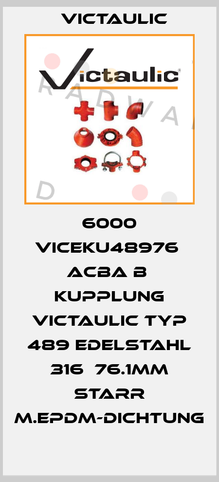 6000 VICEKU48976  ACBA B  Kupplung Victaulic Typ 489 Edelstahl 316  76.1mm starr m.EPDM-Dichtung Victaulic